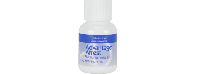 Silver Diamine Fluoride: to Arrest Cavitated Lesions