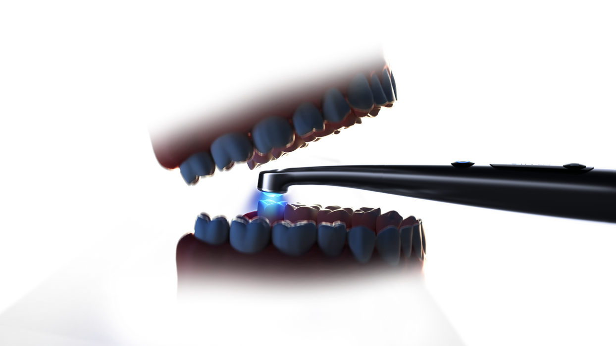Woodpecker - O-Star Pro - Lampe à polymériser - JDIQ - Oral Science