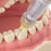 Woodpecker - Super Pen - Electronic Anesthesia Delivery Syringe System