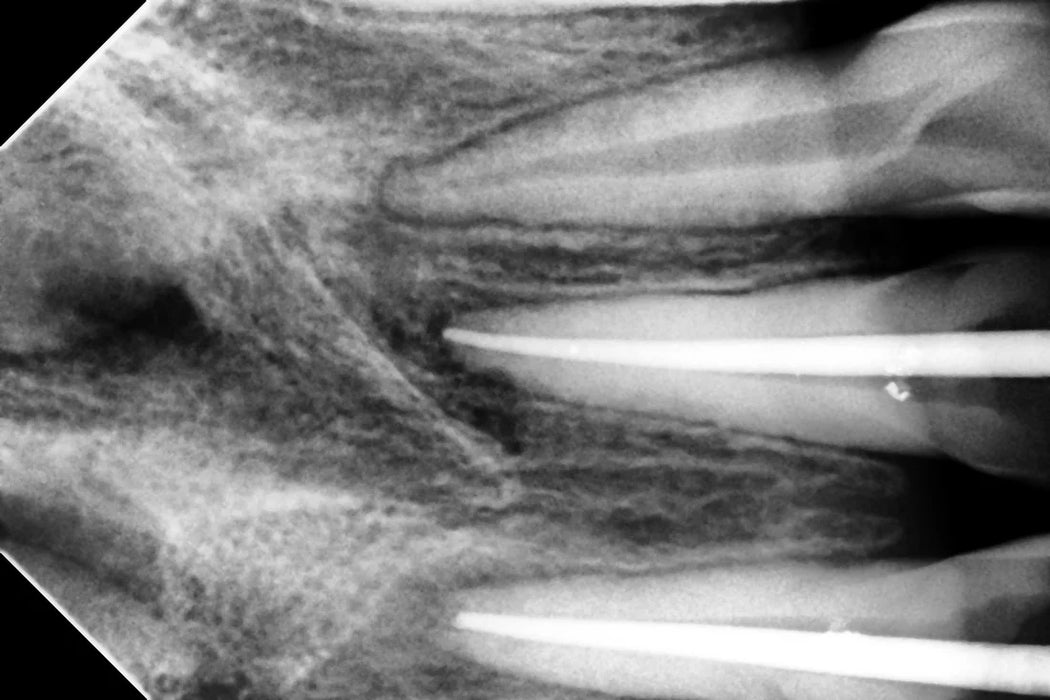 Woodpecker - i-Sensor - Digital X-Ray Sensor - Oral Science