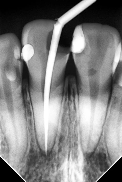 Woodpecker - i-Sensor - Digital X-Ray Sensor - Oral Science