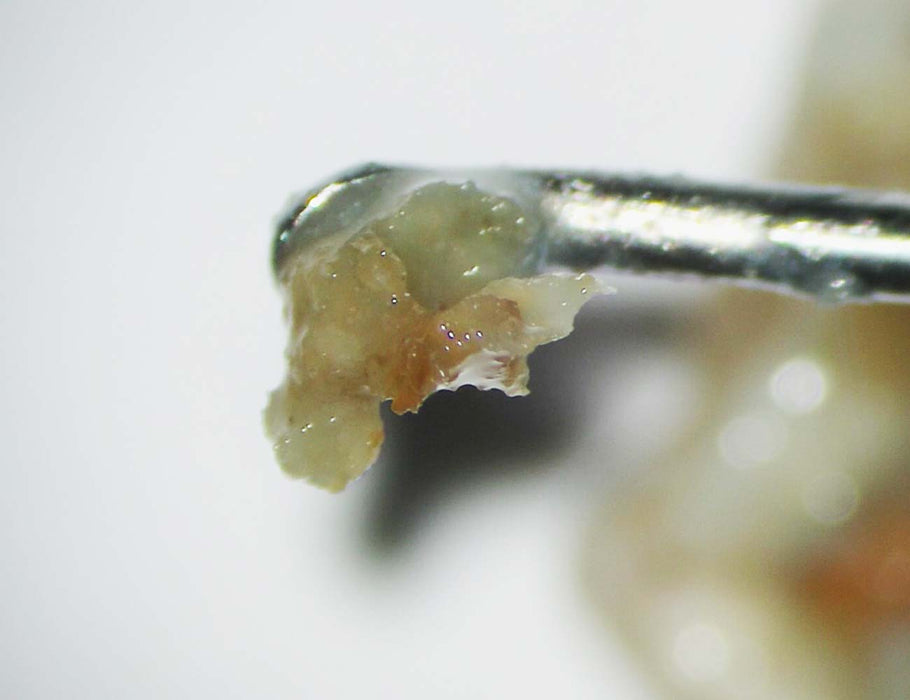 Papacárie — Papaian Gel, 1 mL syringe - Oral Science