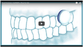 Xylimelts - Adhering Pastilles - Oral Science